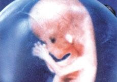Levende foster er dilemma ved aborter