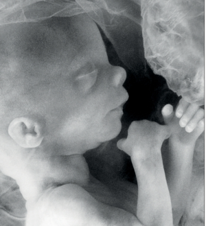 I dag stemmes det over ny abortlov