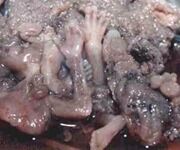 Abortpillen Mifegyn