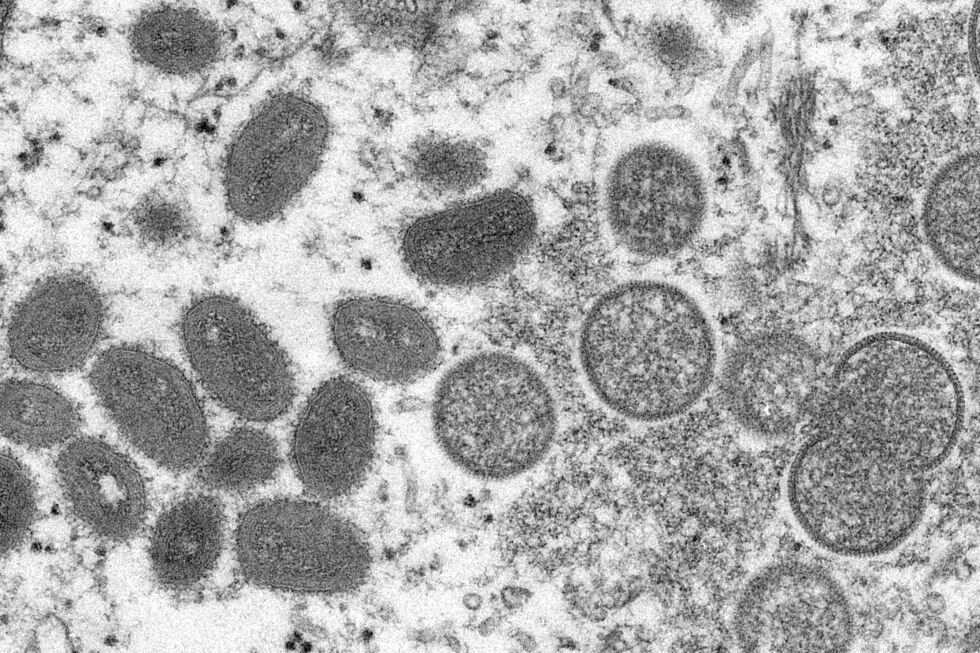 VIRUSET: Dette mikroskop-bildet viser forskjellige typer apekopp-virus.
 Foto: Cynthia S. Goldsmith / Russell Regner / CDC / AP / NTB