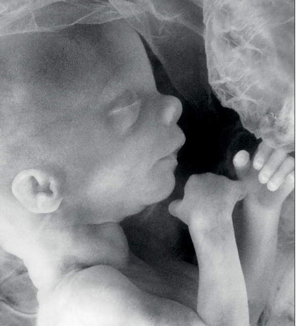 I dag stemmes det over ny abortlov