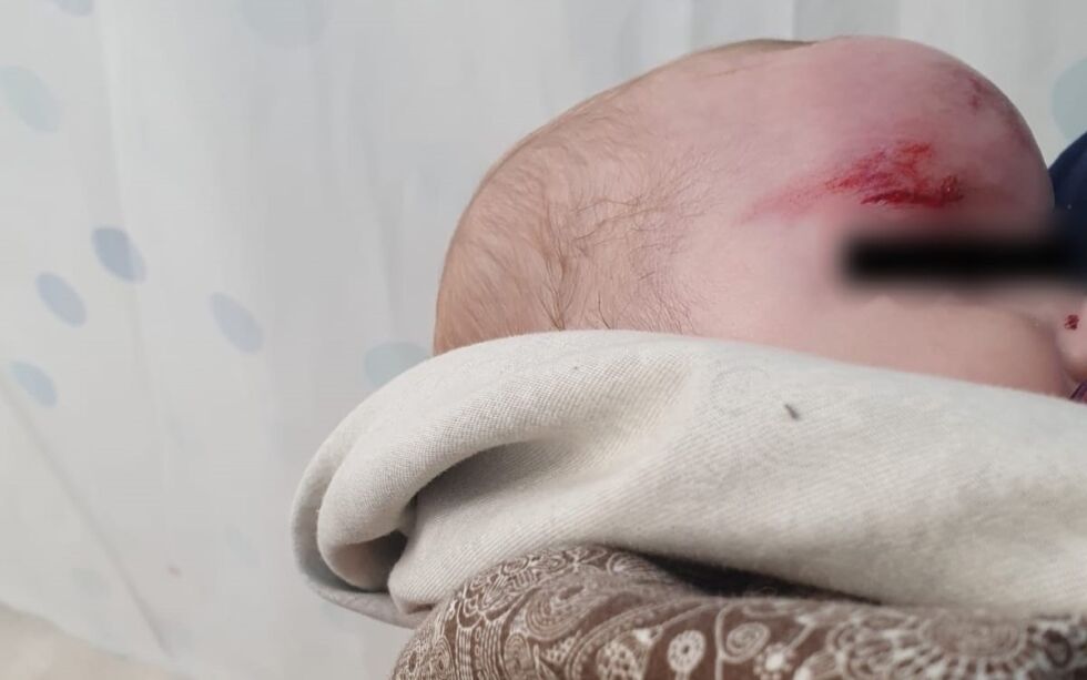Denne syv måneder gamle jødiske jenten ble skadet i hodet etter et terrorangrep fra to arabiske menn i 20-årene.
Foto: Det israelske politiet/TPS