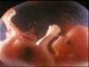 USA gav etter for abortpress i FN