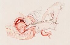 –Tilbyr organer fra aborterte fostre for salg