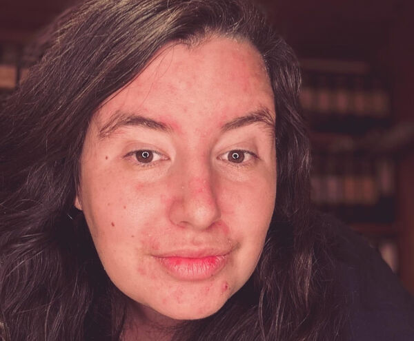 Reagerer på antisemittiske uttalelser fra kristen evangelist