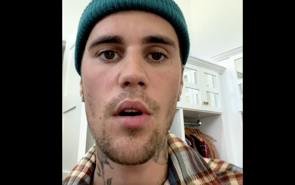 Artisen Justin Bieber viser i en video på Instagram at han ikke kan blunke eller smile på høyre side, fordi et virus har angrepet nerver i halve ansiktet hans.
 Foto: Skjermdump fra Instagra