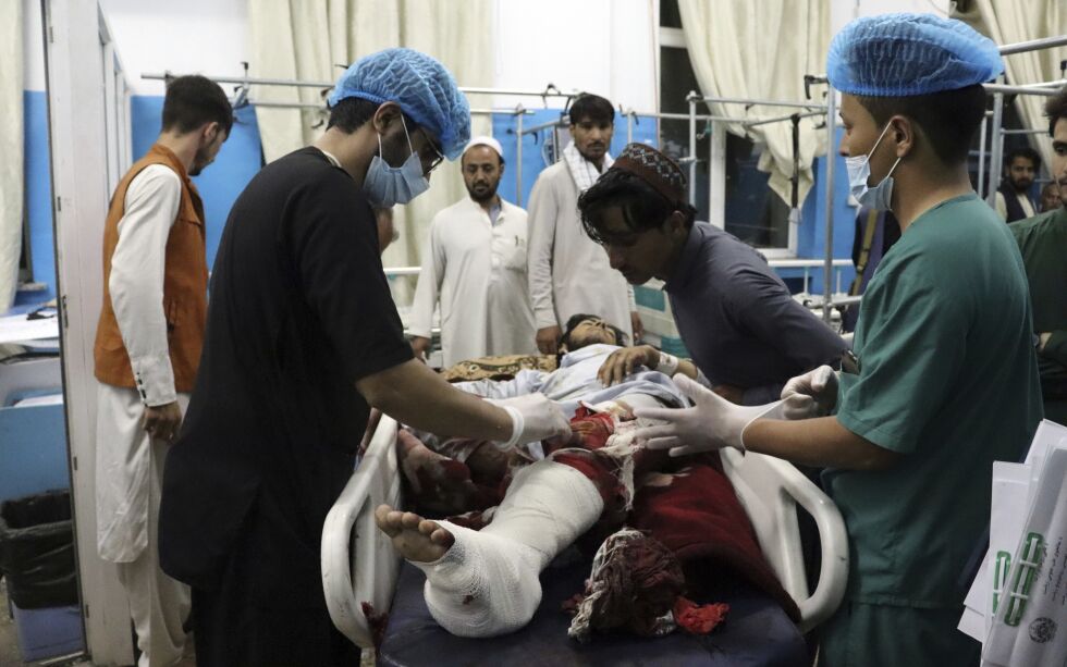 Et stort antall mennesker ble såret i terrorangrepene i Kabul i tillegg til de 85 som er bekreftet drept. Bildet viser en mann som får behandling på et sykehus i Kabul.
 Foto: NTB
