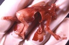 Jenter blør ihjel av abortpille