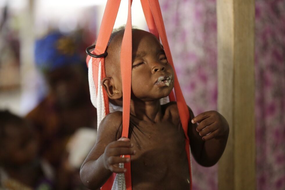 Et underernært barn veies på en Leger Uten Grenser-klinikk i Maiduguri i Nigeria. UNICEF advarer om at 1,4 millioner barn er i akutt hungersnød i Nigeria, Sør-Sudan, Somalia og Jemen.
 Foto: AP / Sunday Alamba / NTB scanpix