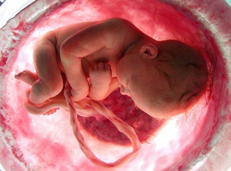 Abort: Selvbestemmelse sier man. Hvem har spurt barnet? spør Anita Apelthun Sæle.
 Foto: CP Photo/Alliance Atlantis