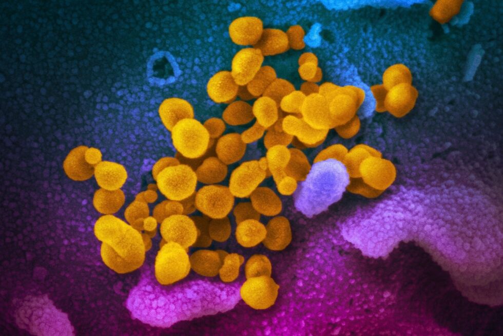 Britiske myndigheter har på rekordtid fått i gang klinisk testing av seks medisiner mot koronavirus. Først ut er medisinen Bemcentinib fra Bergenbio i Norge.
 Foto: NIAID-RML / AP / NTB scanpix
