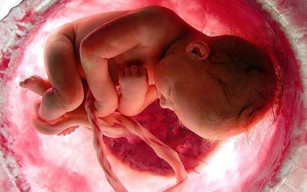 – Å si at abort ikke er drap, er å kamuflere virkeligheten