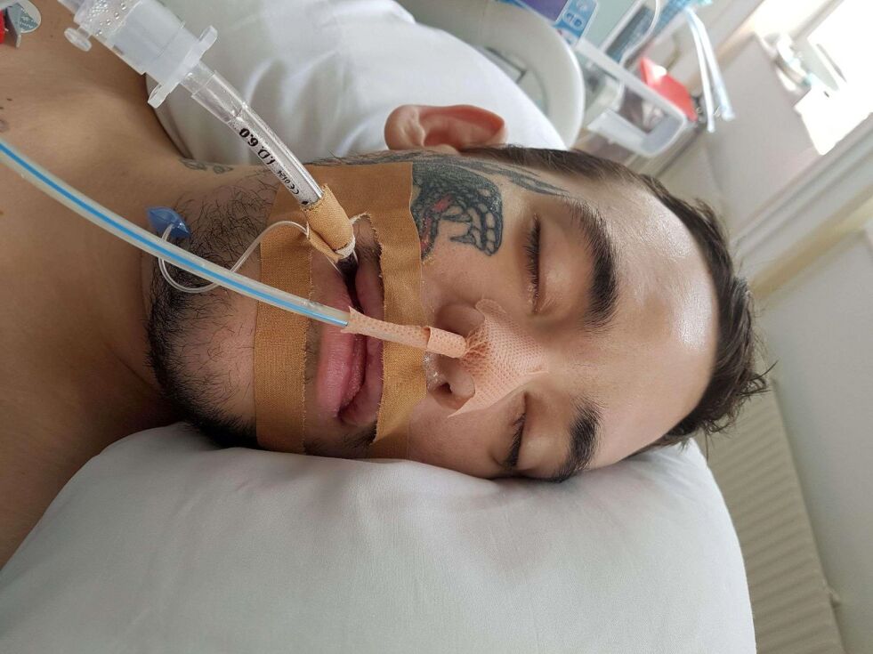 12 DAGAR: Etter ein overdose hamna Kim i respirator i tolv døgn. Både legane og mor hans trudde han kom til å dø.
 Foto: Privat