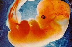 Sa nei til strengere abortlov